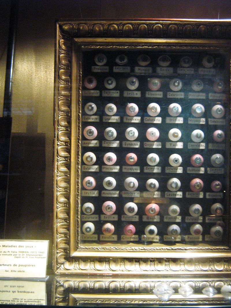 Yeux maladies
