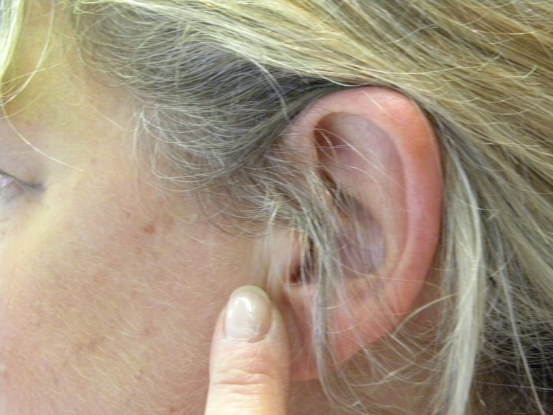 Oreille1