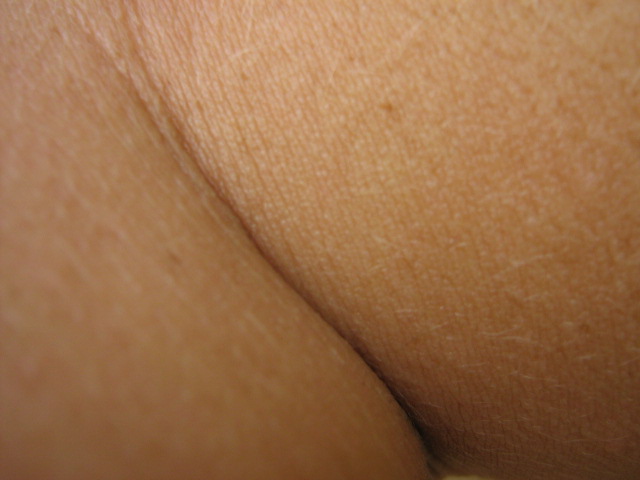 Peau